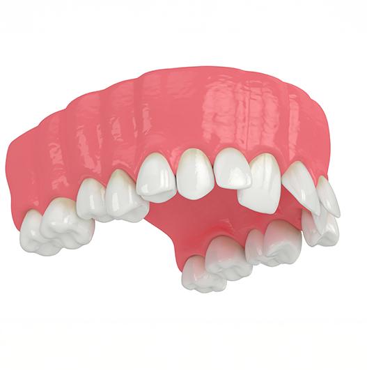 Calgary Braces | North Calgary Orthodontics | Orthodontist NW Calgary