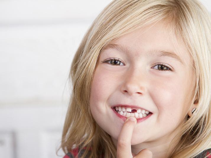 Early Orthodontic Treatment Phase 1 | North Calgary Orthodontics | Orthodontist Calgary