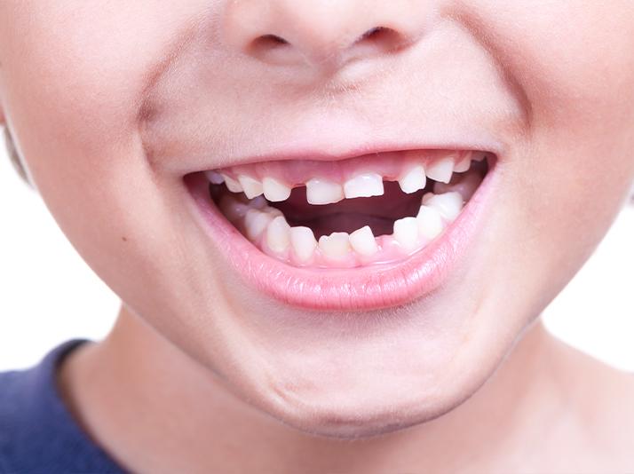 Early Orthodontic Treatment | North Calgary Orthodontics | Orthodontist Calgary