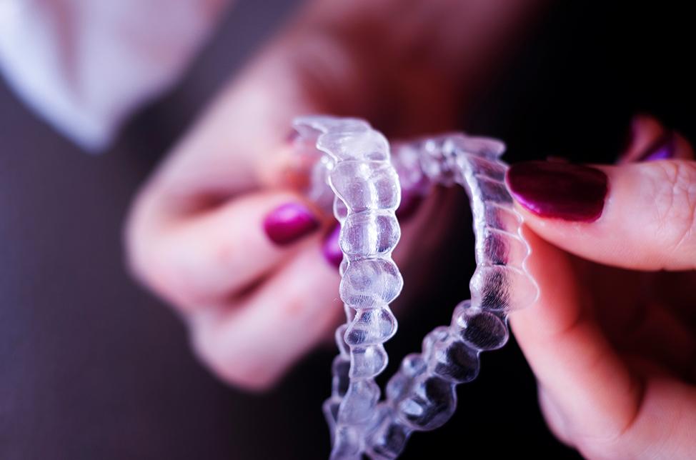 What is a Retainer | North Calgary Orthodontics | Orthodontist Calgary